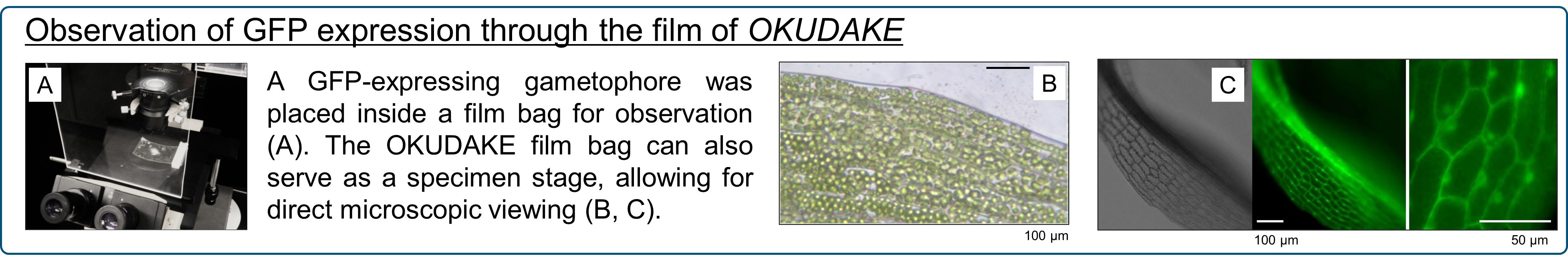 植物ヒメツリガネゴケ顕微鏡観察の画像